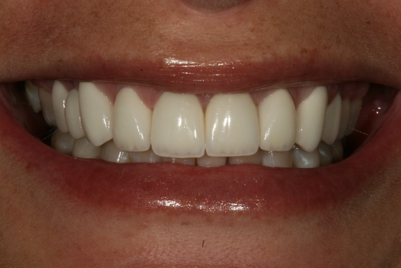 Lisbon Dental Spa Clínica Estética orofacial